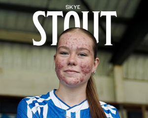 Skye Stout silences trolls with goal on debut after online abuse